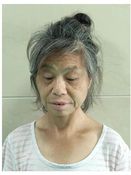 走失者照片 中山寻亲：五旬女子被救助，自述叫谭...