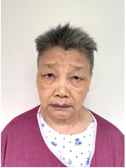 走失者照片 贵阳清镇寻亲：五旬女子被救助，精神...