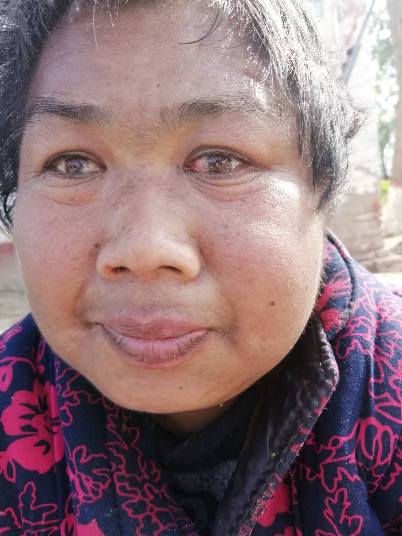 走失者照片 濮阳寻亲：中年女子被救助，穿花棉衣...