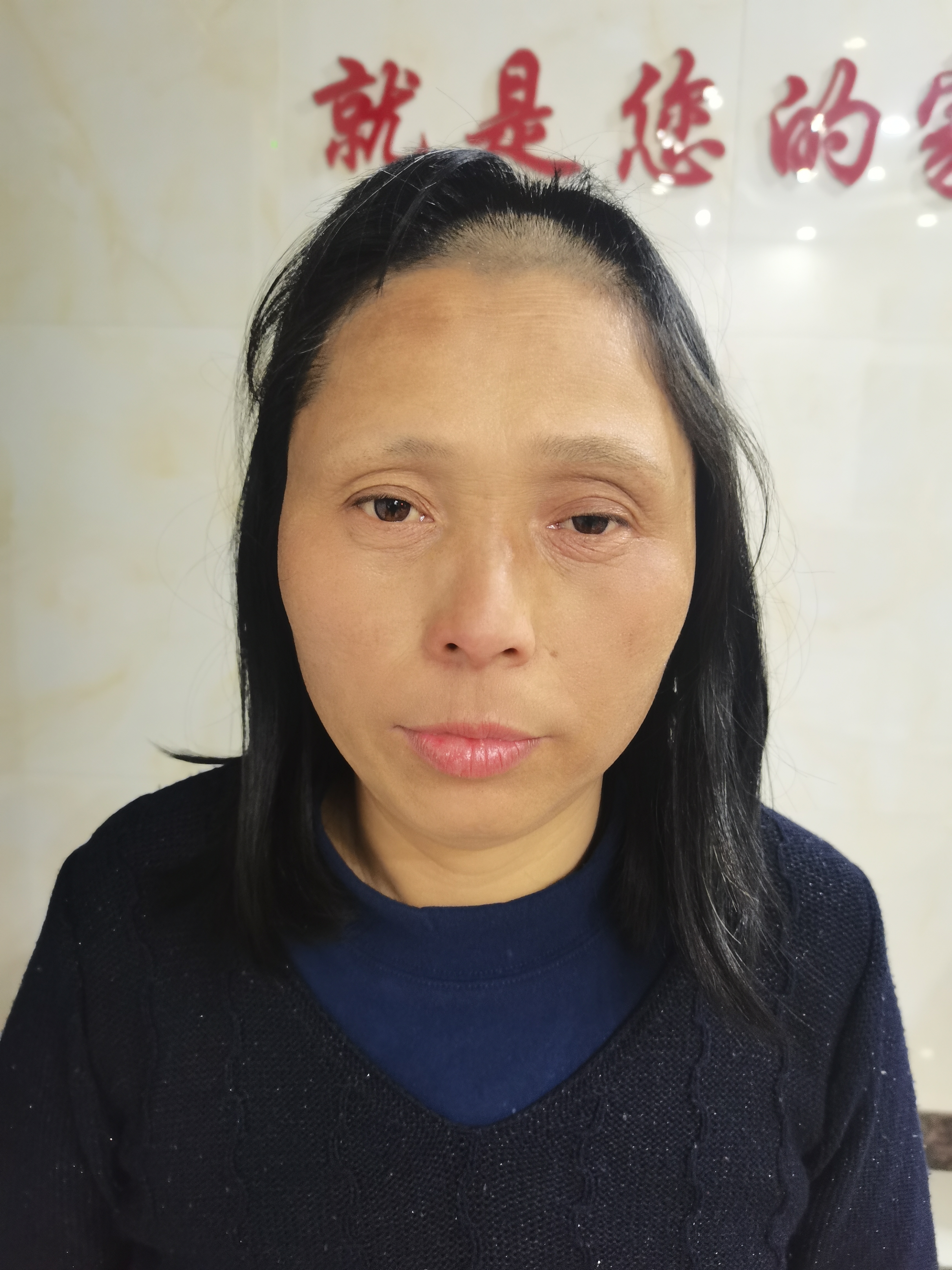 走失者照片 常德寻亲:五旬女子被救助,自述叫罗...