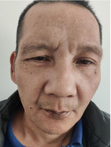 走失者照片 中山青年男子被救助，精神异常