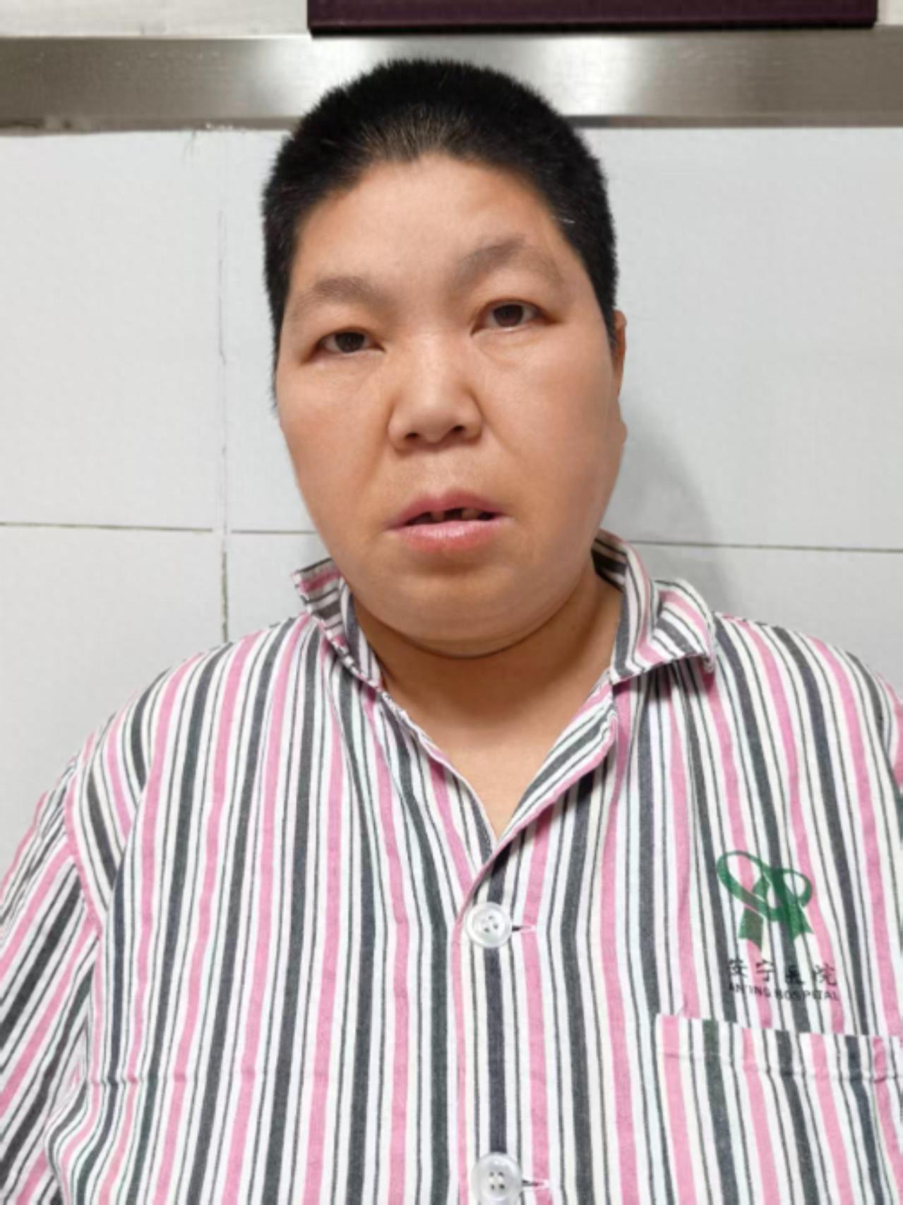 走失者照片 乌鲁木齐市寻亲：五旬女子被救助，自...