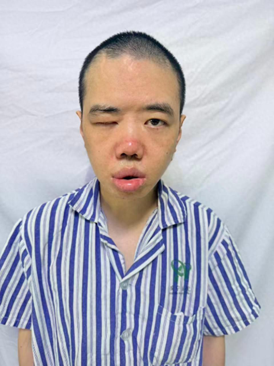 走失者照片 乌鲁木齐市寻亲：青年男子被救助，自...