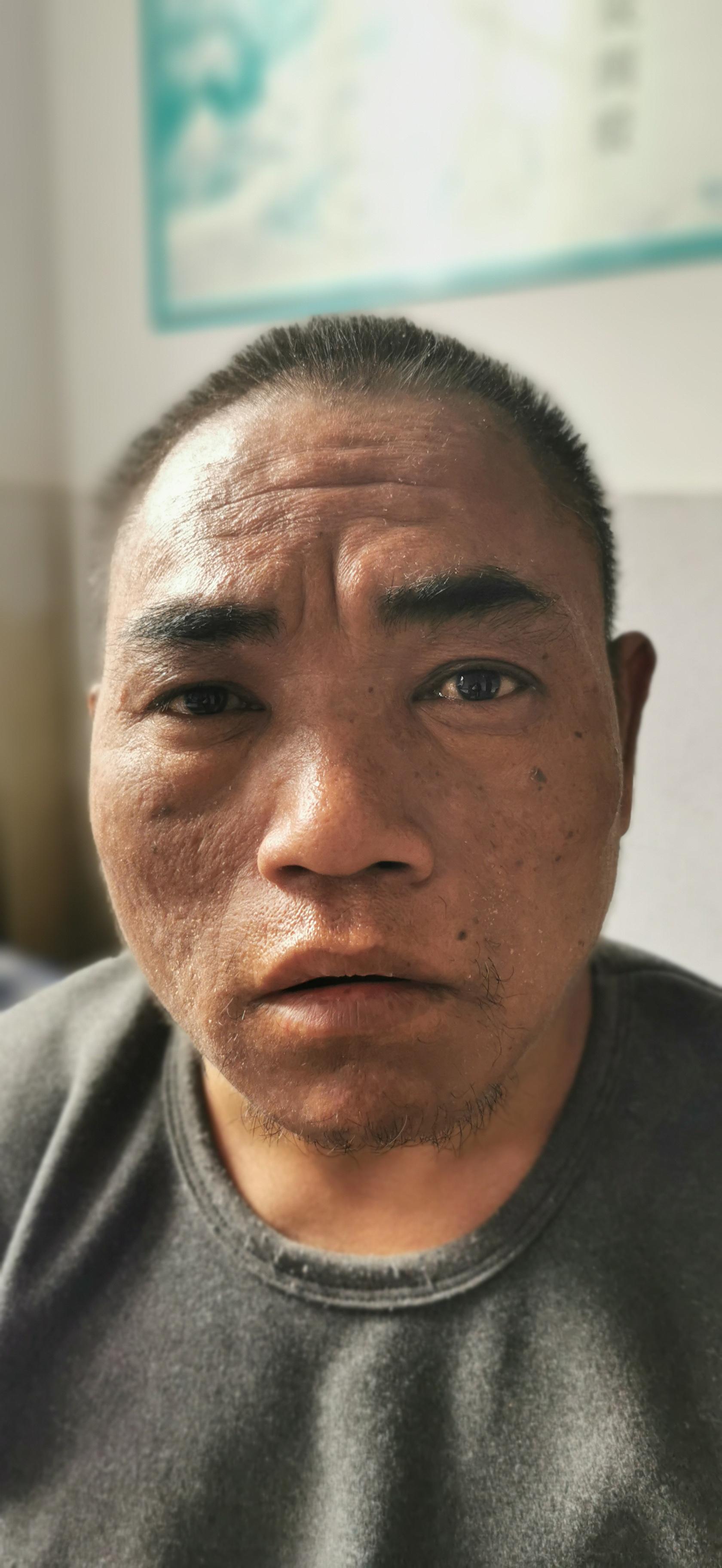 走失者照片 大连寻亲：青年男子被救助，自述叫肖...