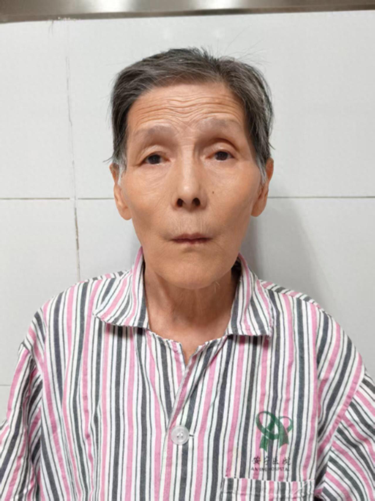 走失者照片 乌鲁木齐市寻亲：七旬老太被救助，自...