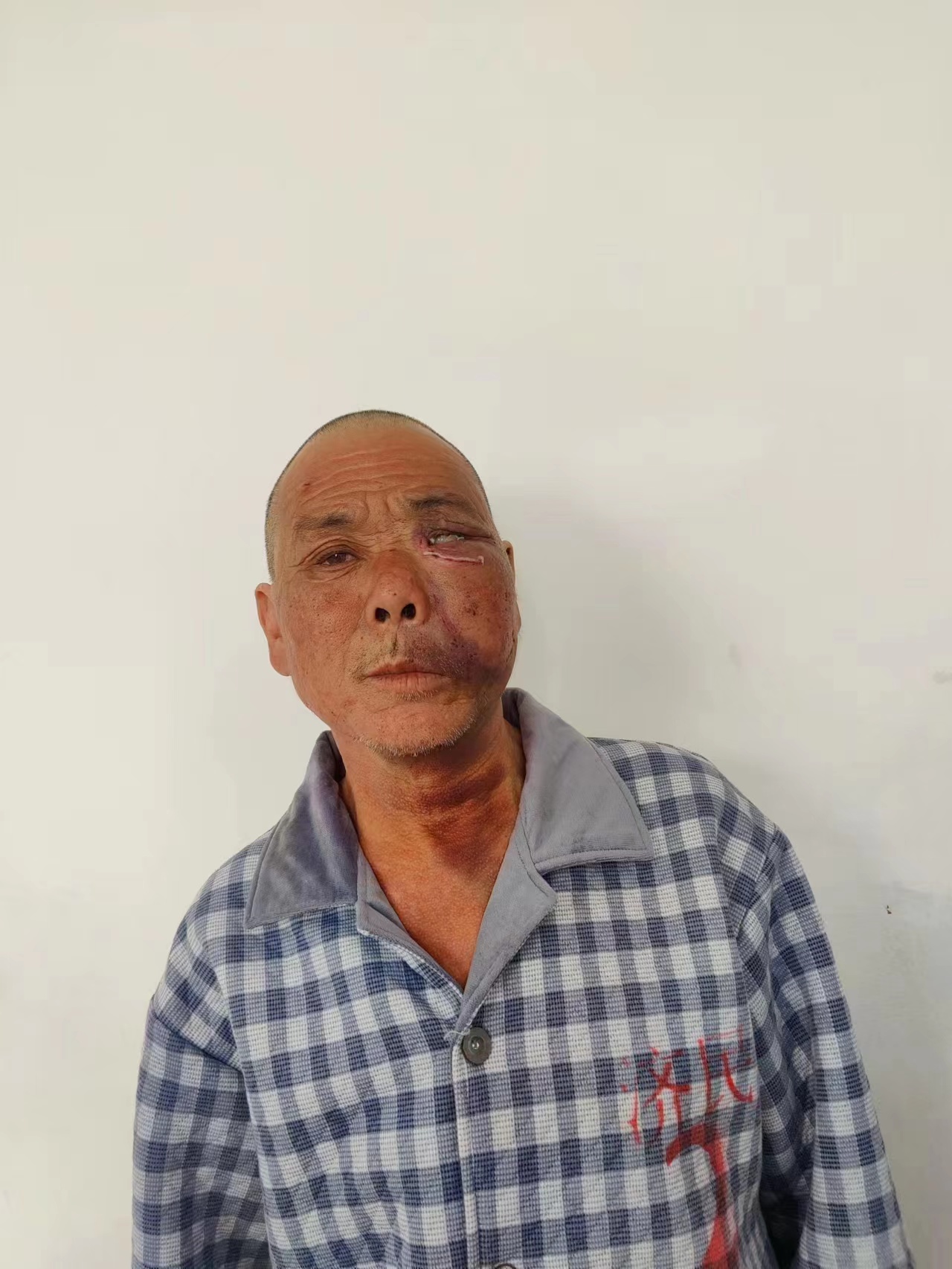 走失者照片 天津寻亲：五旬男子被救助，穿黑色外...