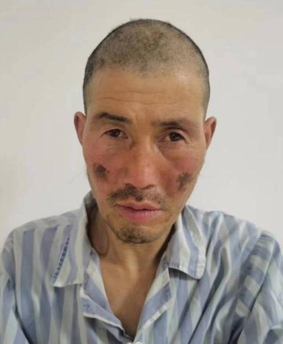 走失者照片 安庆寻亲：桐城中年男子被救助，戴红...