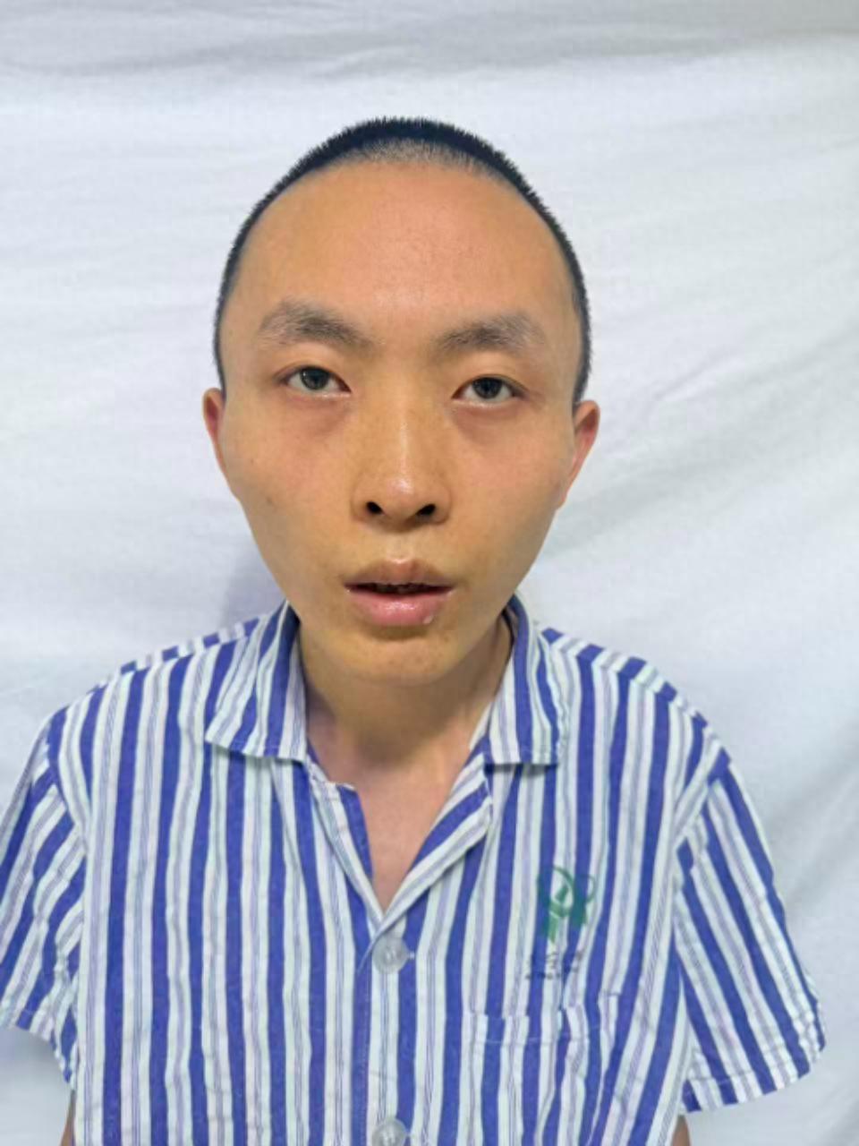 走失者照片 乌鲁木齐市寻亲：青年男子被救助，自...