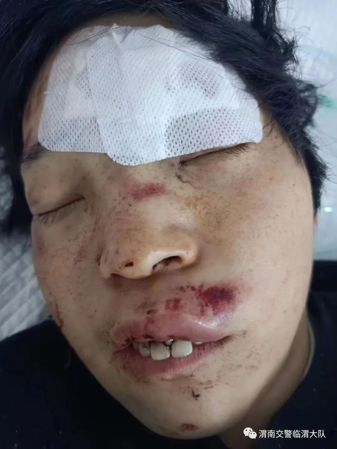 走失者照片 渭南寻亲：中年女子遭遇车祸，穿白色...
