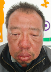走失者照片 滨州寻亲：青年男子被救助，自述叫李...
