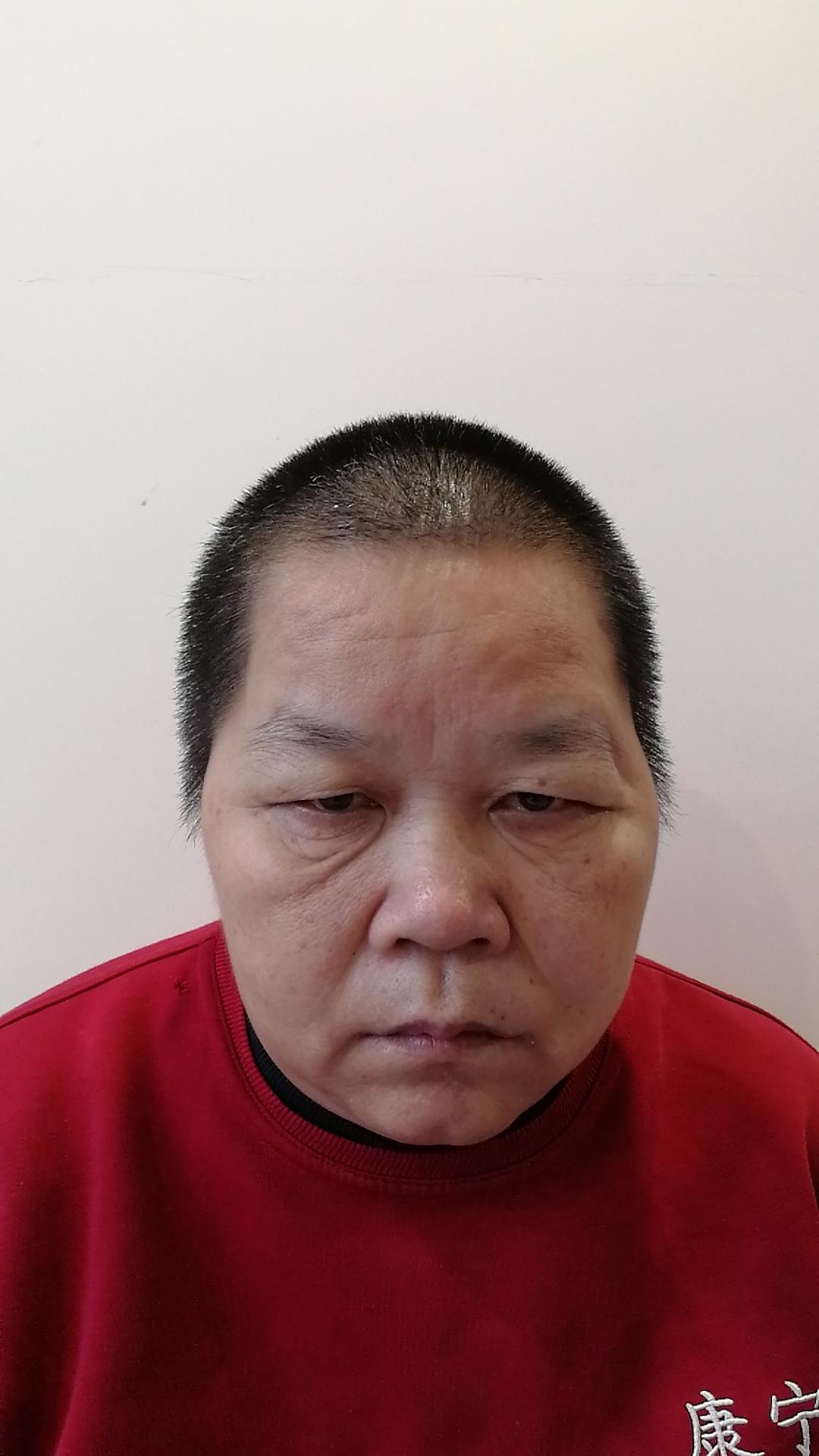 走失者照片 深圳寻亲：五旬女子被救助，疑似名叫...
