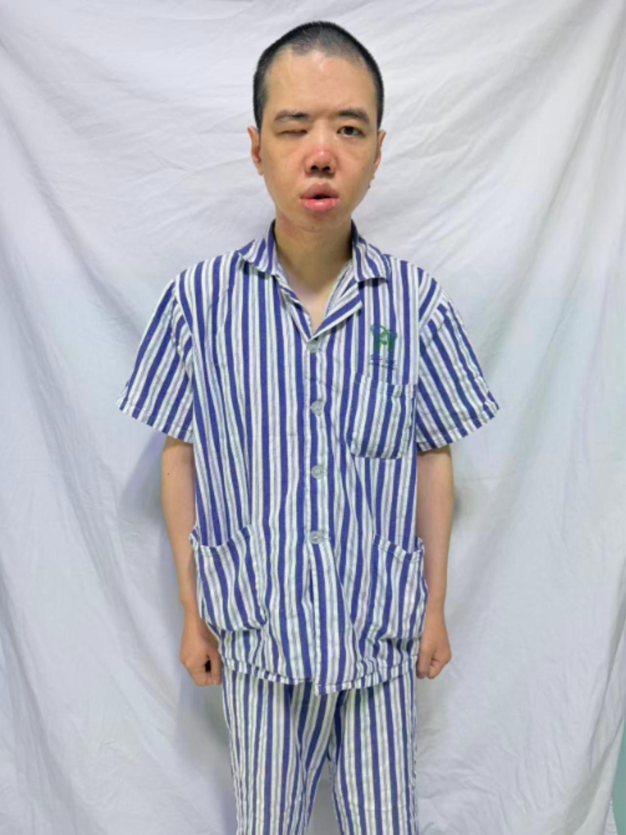 走失者照片 乌鲁木齐市寻亲：青年男子被救助，自...