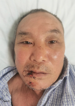 走失者照片 柳州寻亲：六旬老人被救助，自述叫杨...