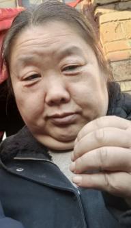 走失者照片 三门峡急寻：中年女子走失，高1米6...