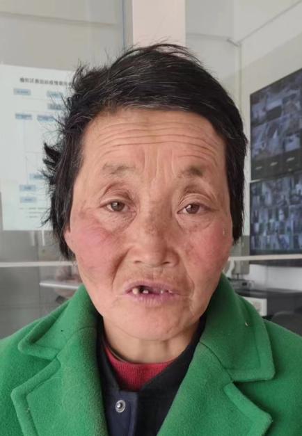 走失者照片 榆林寻亲：五旬女子被救助，自述叫陈...