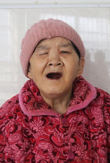 走失者照片 湘西州吉首市寻亲：七旬老太被救助多...