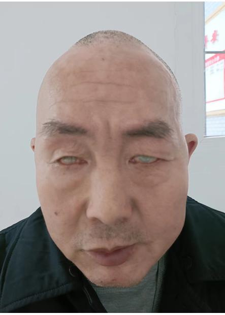 走失者照片 重庆寻亲：七旬老人被救助，穿黑色上...