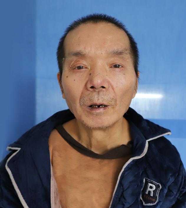 走失者照片 寻亲：湘西州吉首市五旬男子被救助，...