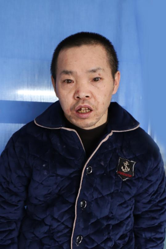 走失者照片 湘西州吉首市寻亲：青年男子被救助，...