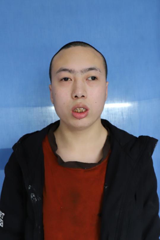 走失者照片 湘西州寻亲：吉首市青年男子被救助多...