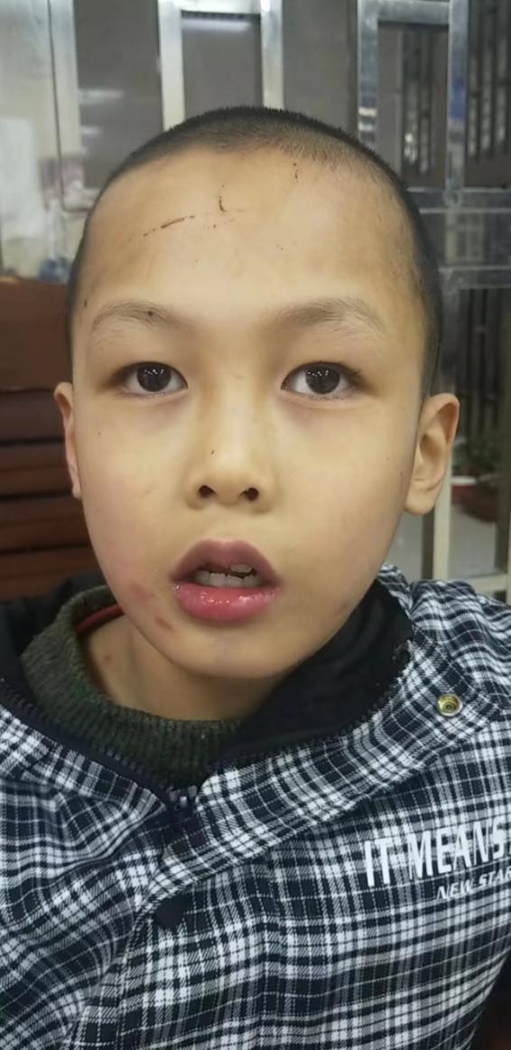 走失者照片 谁家孩子走丢了?平顶山汝州市9岁男...