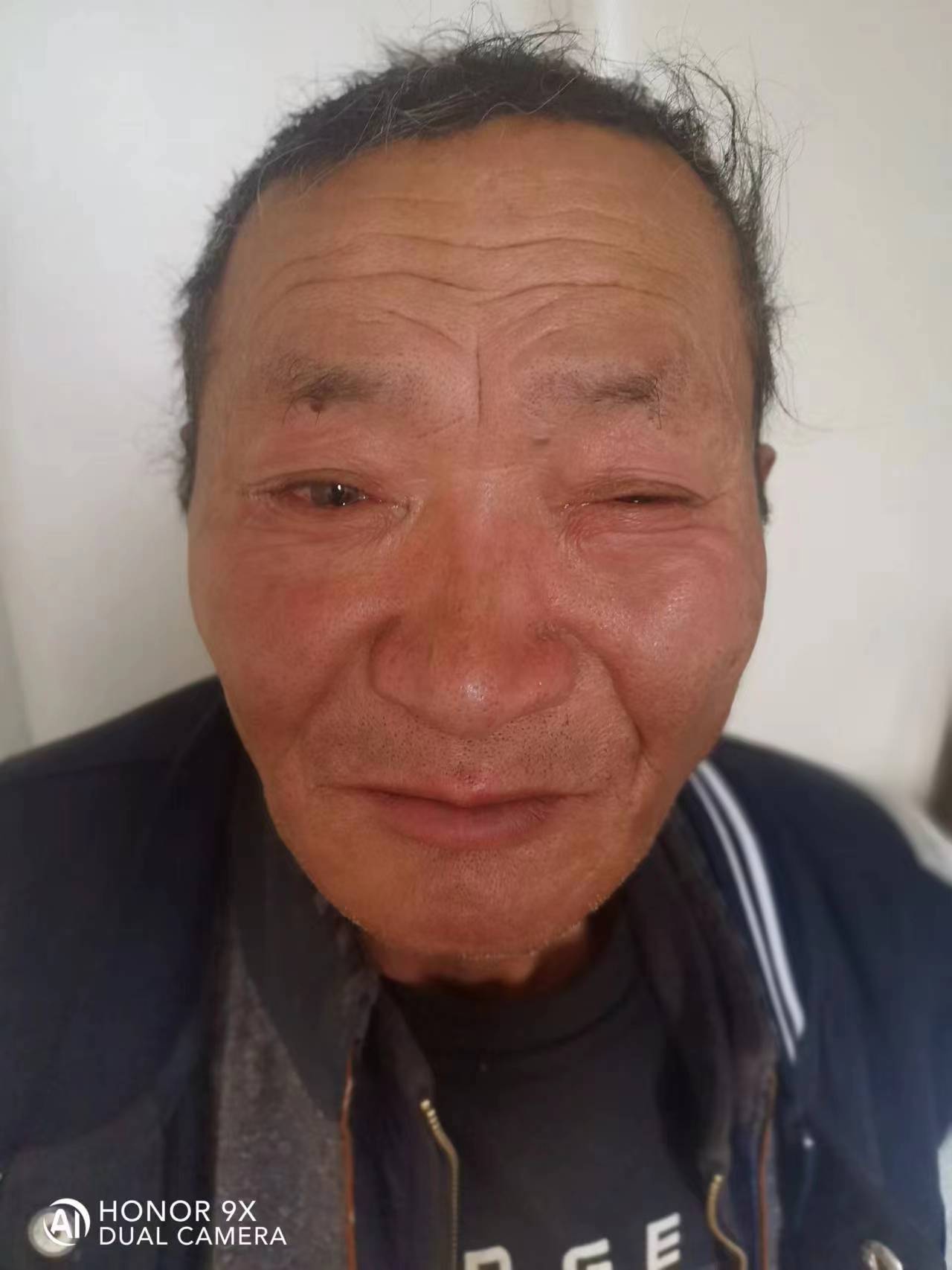 走失者照片 宿州寻亲：五旬男子被救助，穿黑色格...