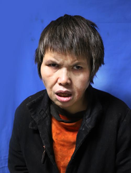 走失者照片 湘西州寻亲：吉首青年女子被救助多年...