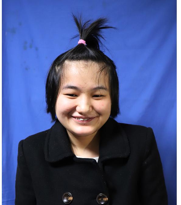走失者照片 寻亲：湘西州吉首市青年女子被救助多...