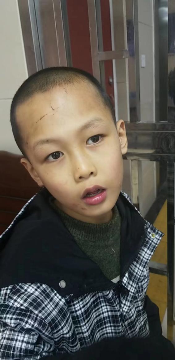 走失者照片 谁家孩子走丢了？平顶山汝州市9岁男...