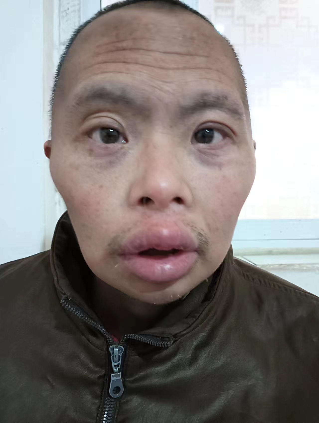 走失者照片 漯河寻亲：青年男子被救助，不愿与人...