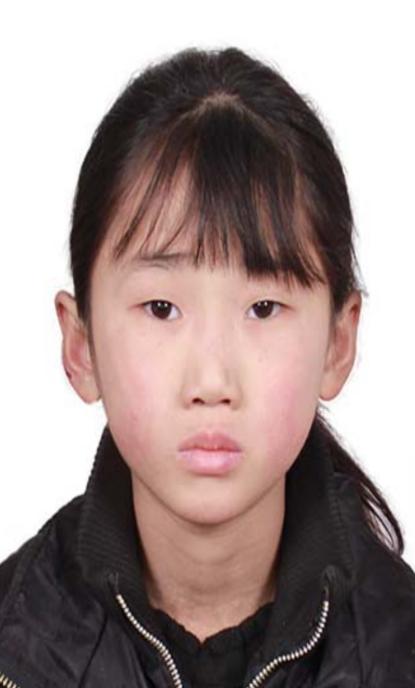 走失者照片 重庆寻亲：10岁女孩被救助多年，现...