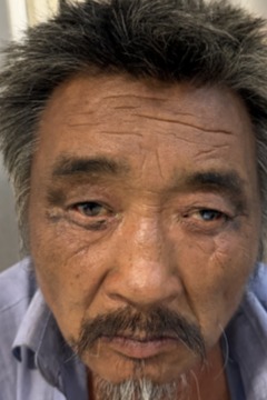 走失者照片 临沂市寻亲：五旬男子被救助，穿蓝色...