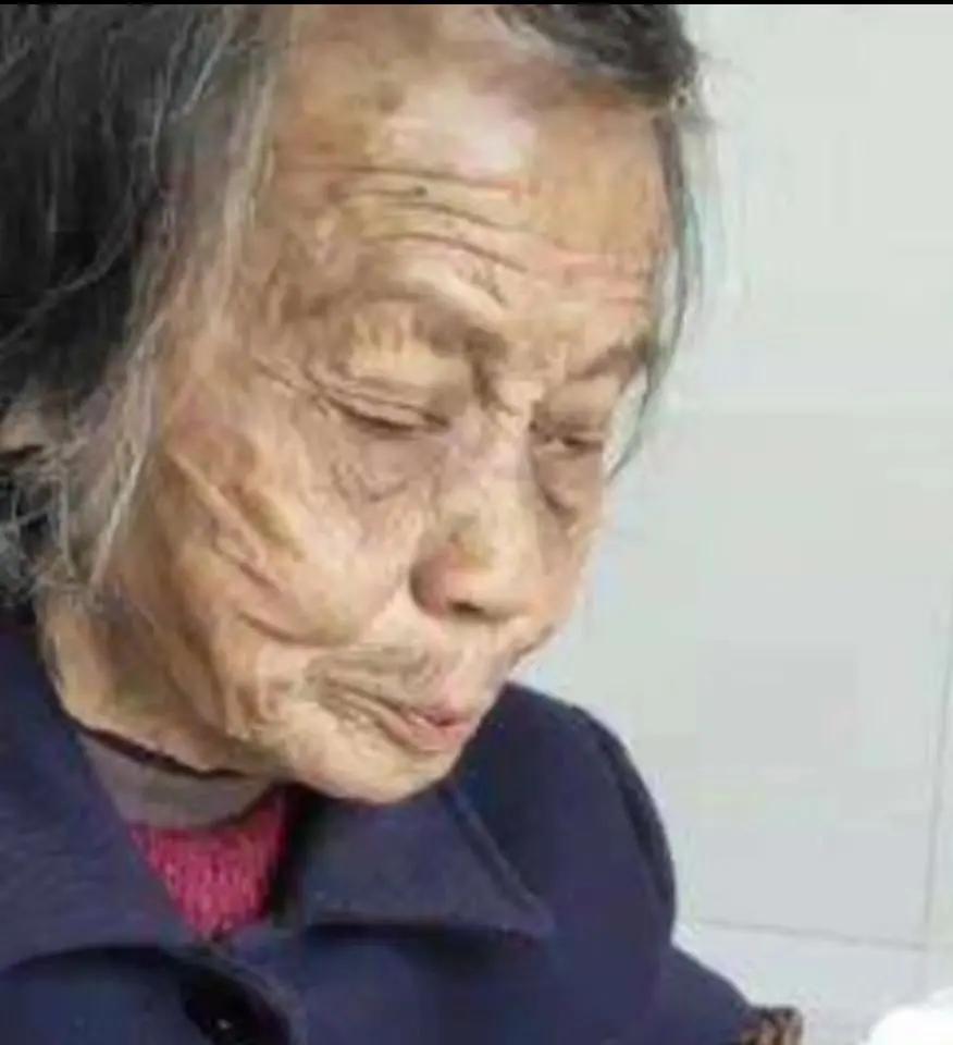 走失者照片 福州急寻：八旬老太走失，穿枣红色毛...
