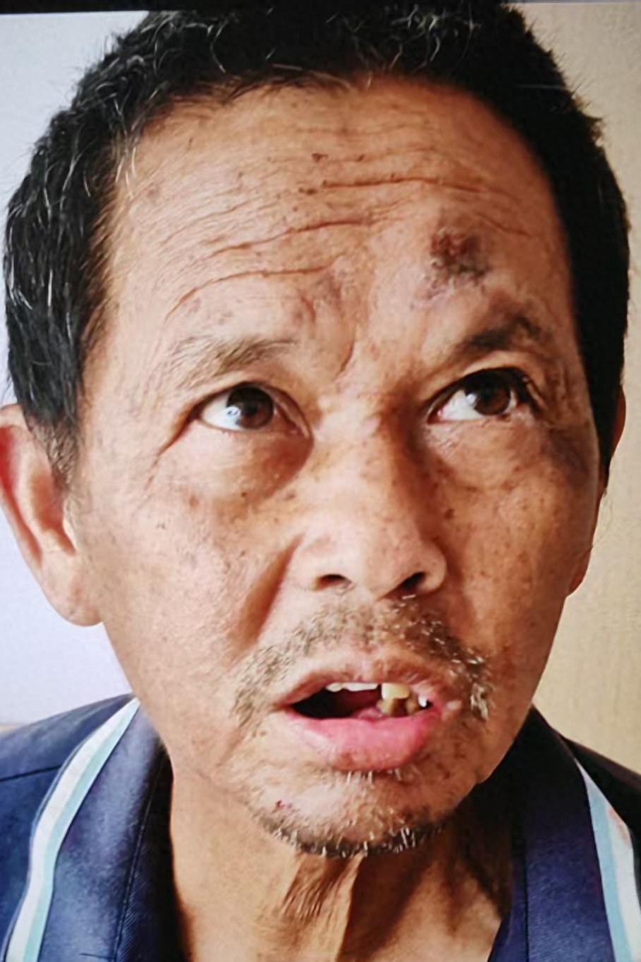 走失者照片 漳州市寻亲：六旬老人被救助，高1米...