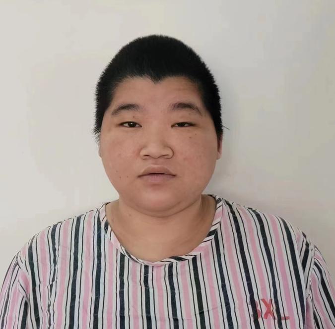 走失者照片 寻亲：茂名高州青年女子被救助，高1...