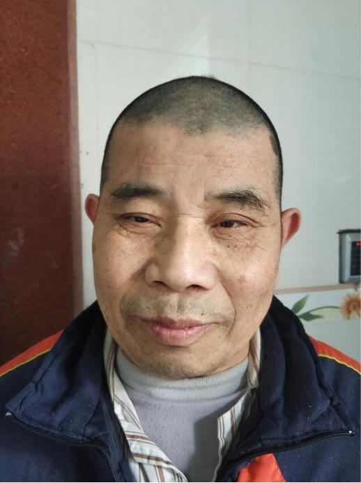 走失者照片 韶关寻亲：五旬男子被救助，自述叫刘...