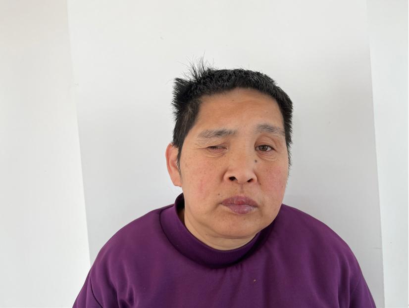 走失者照片 临沂寻亲：中年女子被救助，右眼视力...
