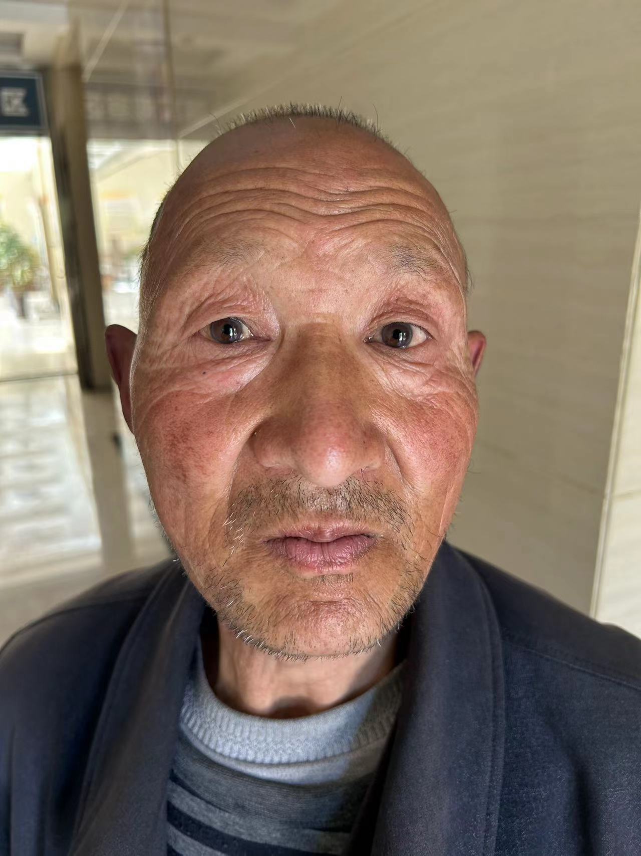 走失者照片 平凉寻亲：六旬老人被救助，自述叫陈...