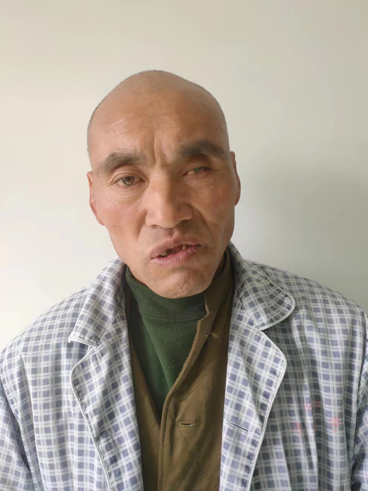 走失者照片 寻亲：五旬男子在晋中被救助数月，疑...