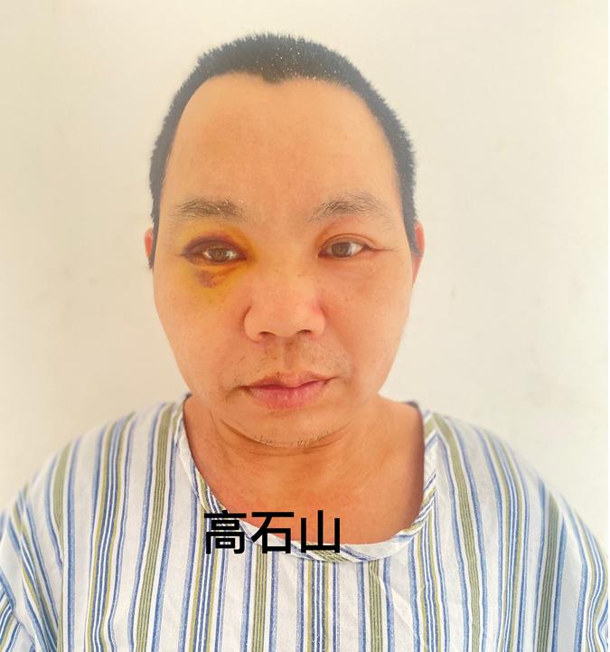 走失者照片 茂名高州寻亲：五旬男子被救助，高1...