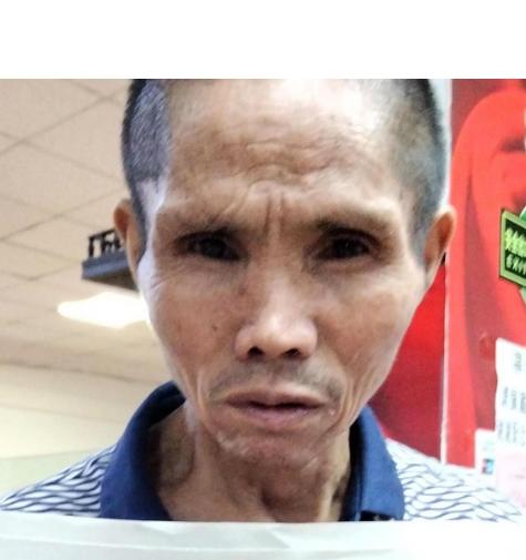 走失者照片 郴州寻人：五旬男子失联，穿黑色衣服...