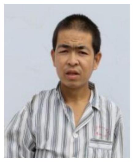 走失者照片 玉溪寻亲：中年男子被救助，高1米6...