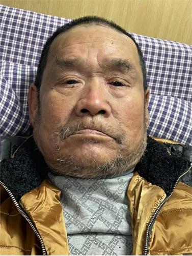 走失者照片 抚州寻亲：六旬老人被救助，福建人，...