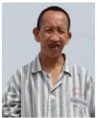走失者照片 玉溪寻亲：中年男子被救助，高1米3...