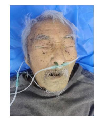 走失者照片 济南寻亲：八旬老人被救助，穿灰色上...