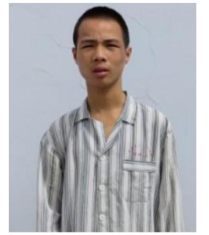 走失者照片 玉溪寻亲：青年男子被救助，高1米6...