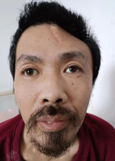 走失者照片 广元寻亲：中年男子被救助，高1米5...