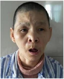 走失者照片 玉溪寻亲：六旬老太被救助多年，疑患...
