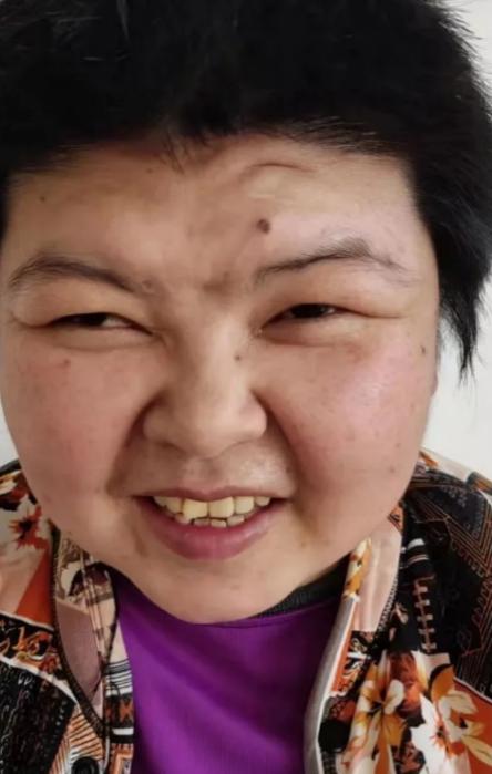 走失者照片 临沂寻亲：青年女子被救助，高1米5...