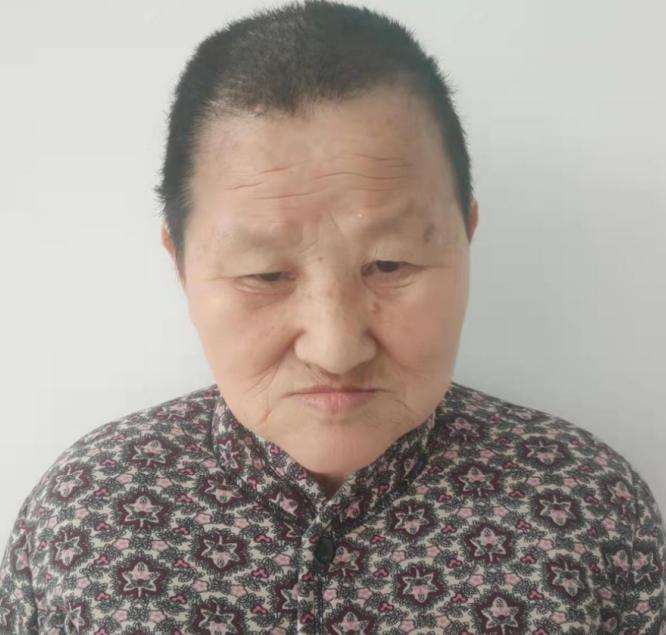 走失者照片 临沂寻亲：七旬老太被救助，高1米6...